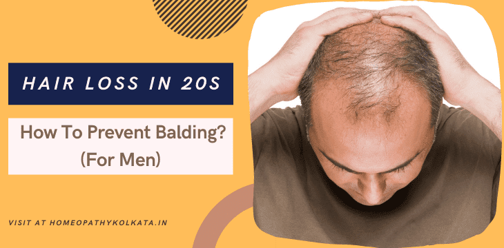 Hair Loss in 20s: How To Prevent Balding? (For Men) - Best Homeopathy  Doctor in Kolkata